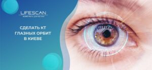 сделать КТ глазных орбит в киеве