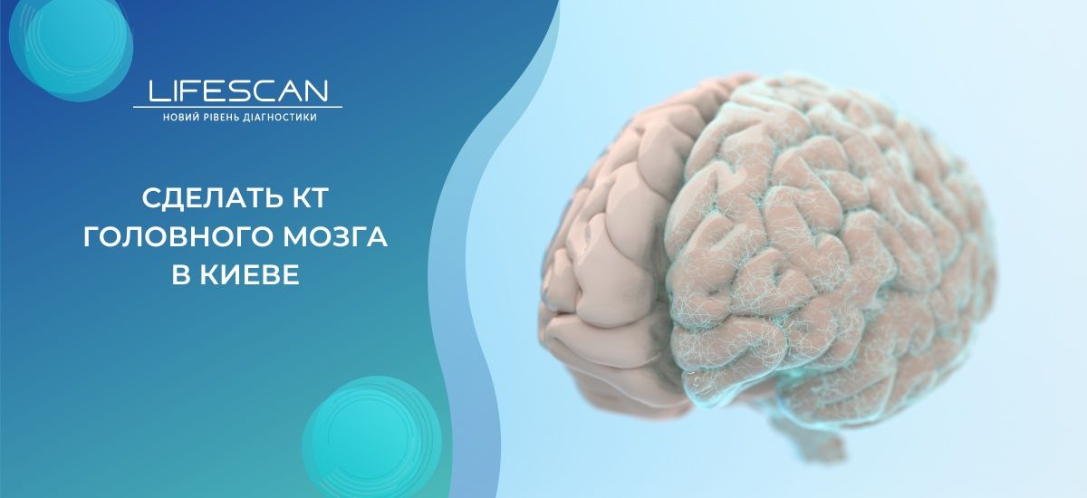 сделать КТ головного мозга в киеве