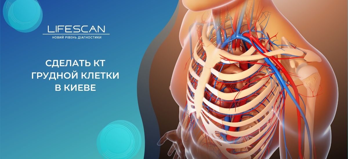 сделать КТ грудной клетки в Киеве