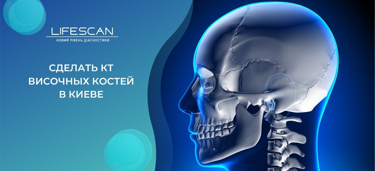 сделать КТ височных костей в киеве