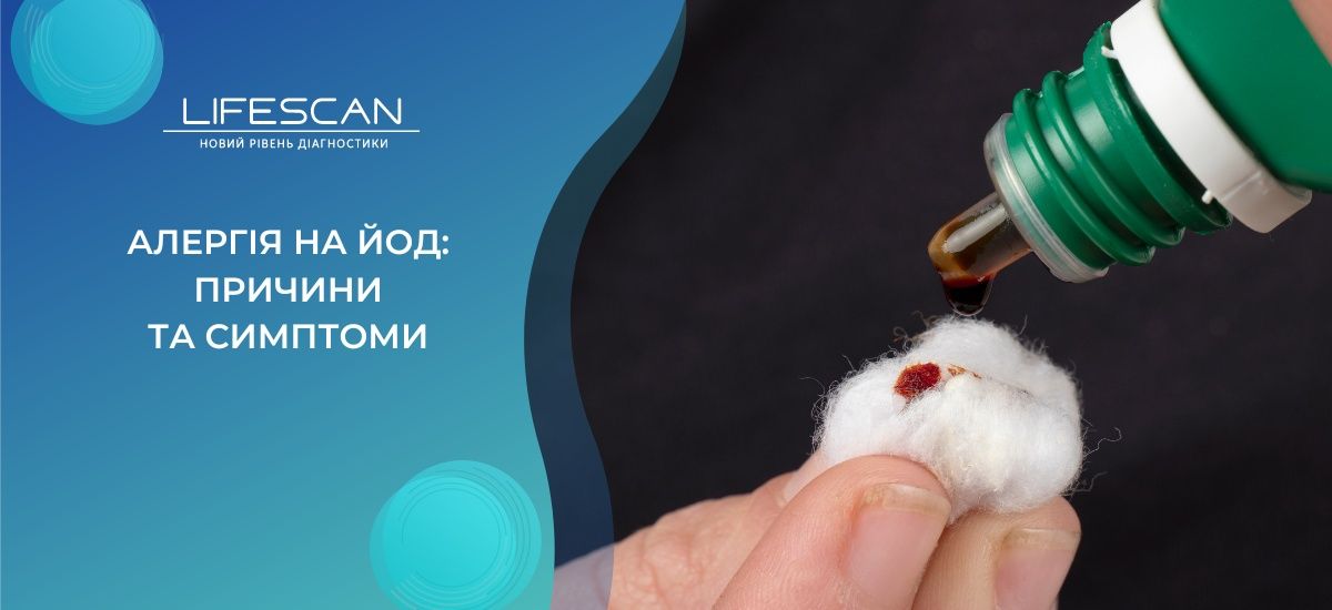 Алергія на йод. Йодовмісні продукти і речовини