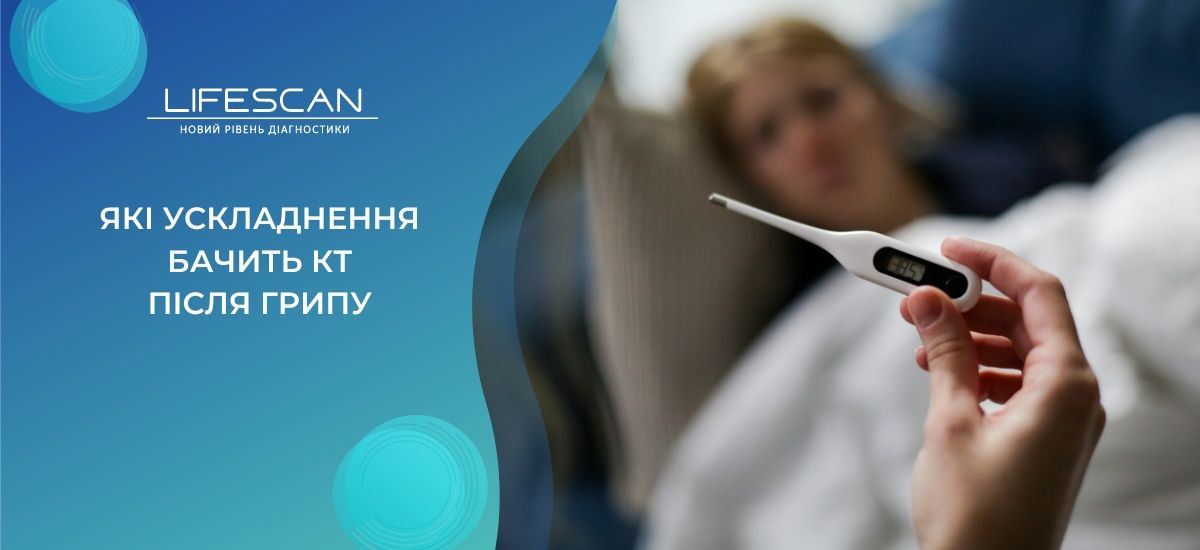 Які ускладнення бачить КТ після грипу у Києві