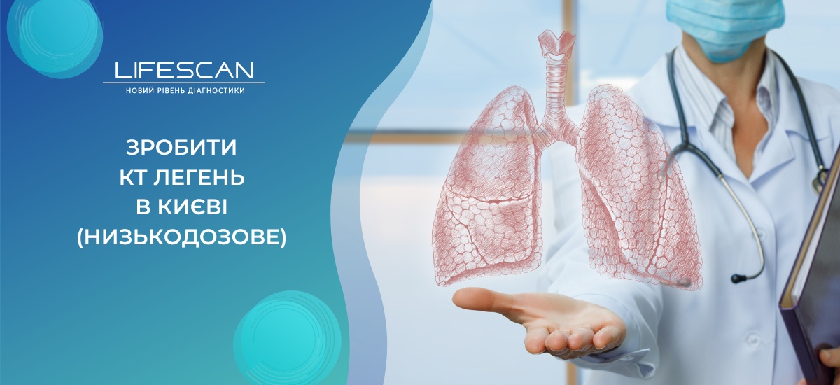 зробити кт легень в києві