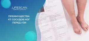 Обследования при болезнях сосудов и вен ног: преимущества КТ перед УЗИ в киеве