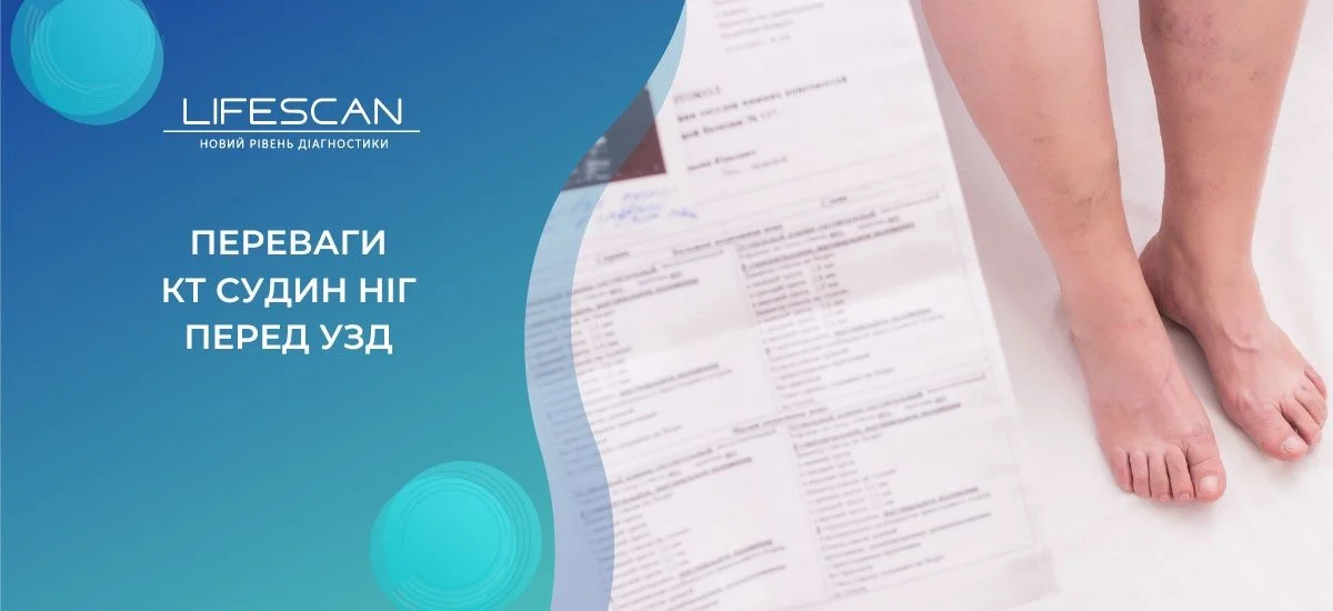Обстеження при хворобах судин та вен ніг: переваги КТ перед УЗД у Києві
