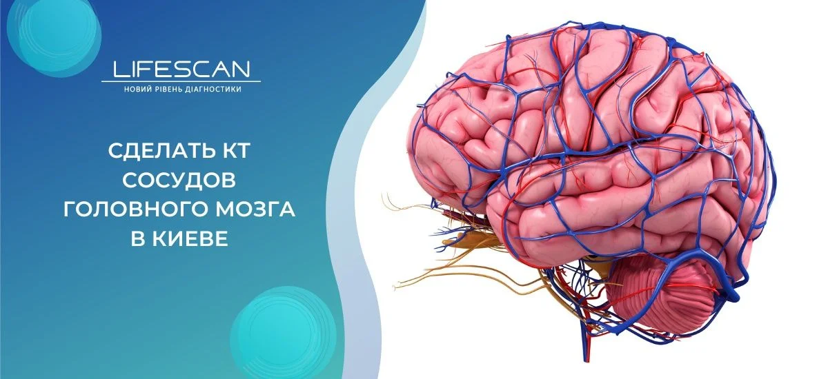 сделать КТ сосудов головного мозга в киеве