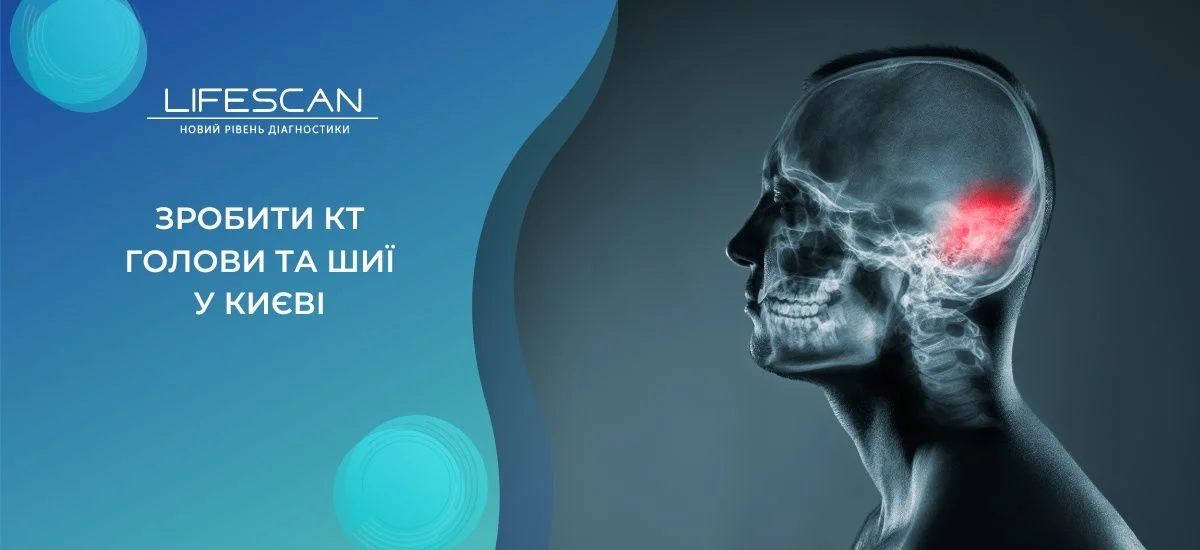зробити КТ голови та шиї у Києві