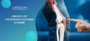 сделать КТ коленного сустава в киеве