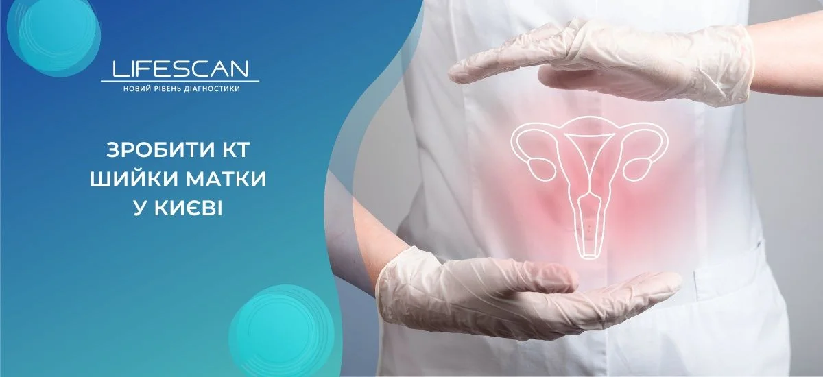 зробити КТ матки у Києві