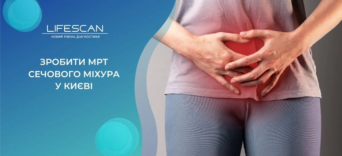 зробити МРТ сечового міхура в Києві
