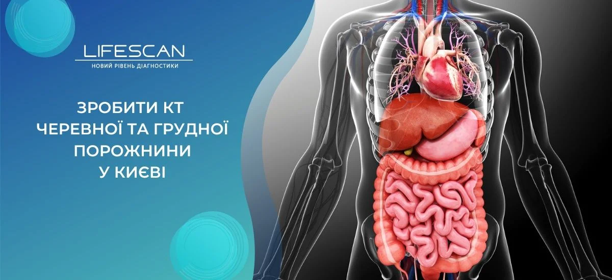 зробити КТ черевної та грудної порожнини у Києві