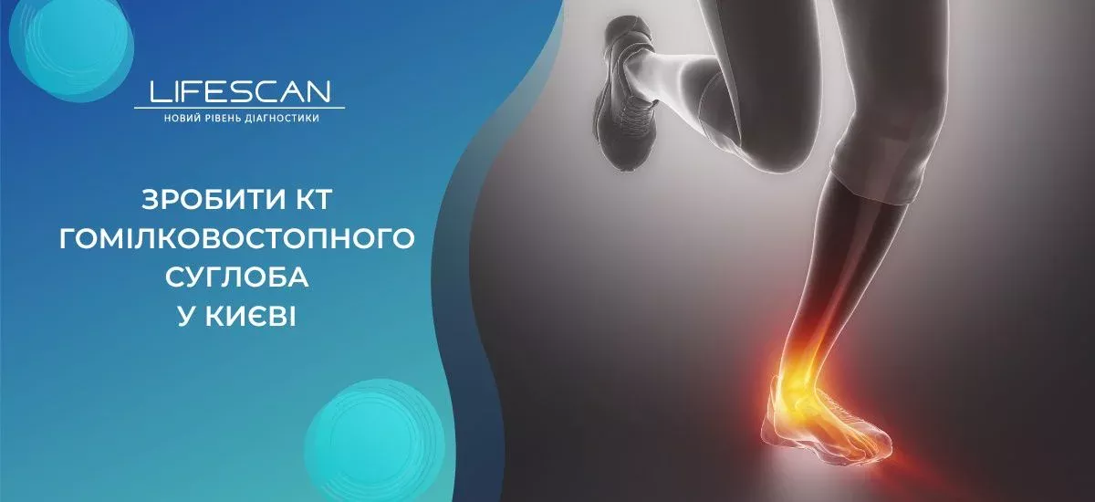 зробити КТ гомілковостопного суглоба в Києві