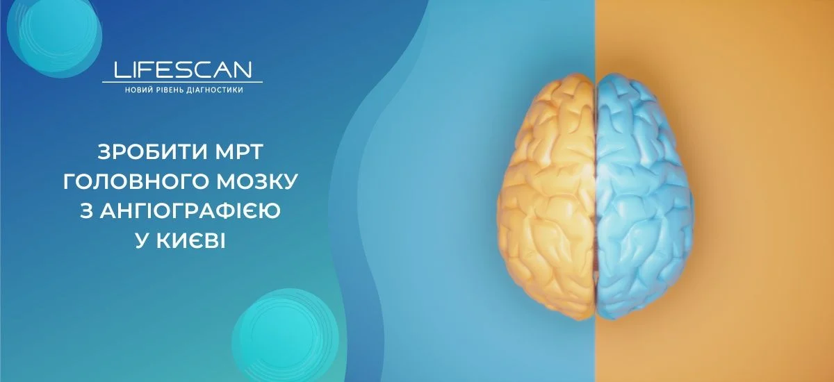 зробити МРТ головного мозку з ангіографією у Києві