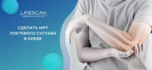 сделать МРТ локтевого сустава в киеве