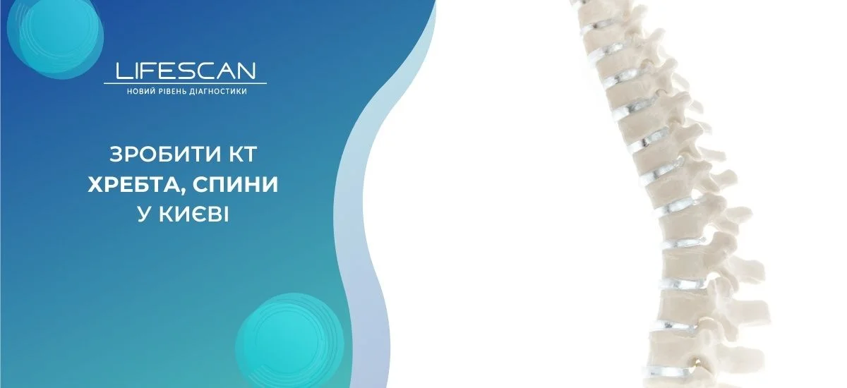 зробити КТ хребта, спини в Києві