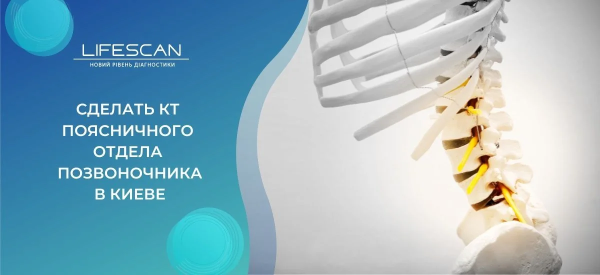 сделать КТ поясничного отдела позвоночника в киеве