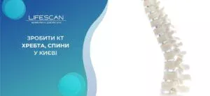 зробити КТ хребта, спини в Києві