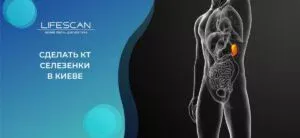сделать КТ селезенки в киеве