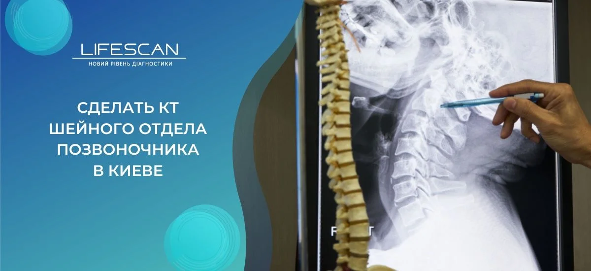 сделать КТ шейного отдела позвоночника в киеве