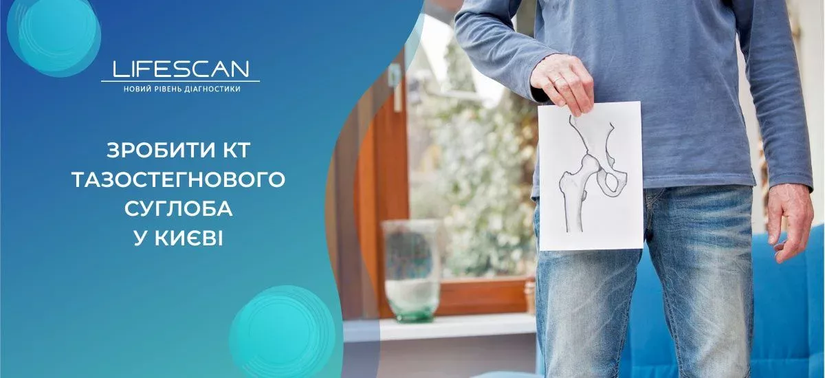 зробити КТ кульшового суглоба у Києві