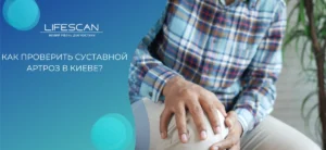 суставной артроз