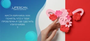 Киста яичника