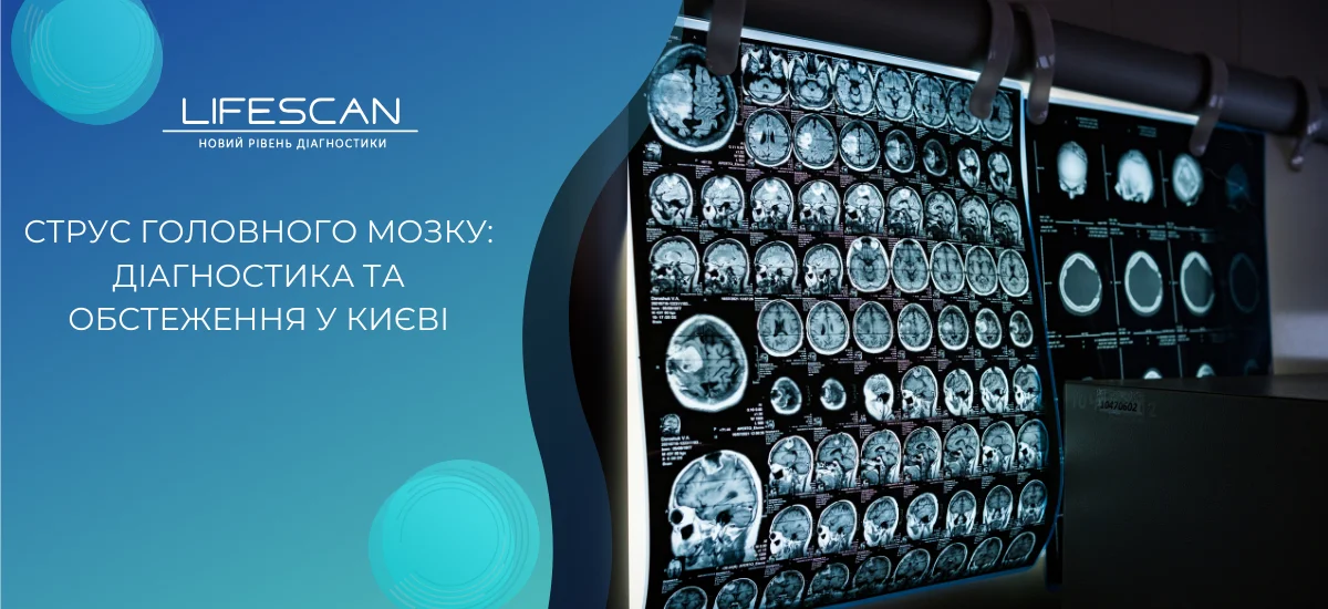 Струс головного мозку