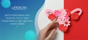 Киста яичника