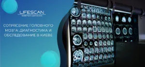 Сотрясение головного мозга