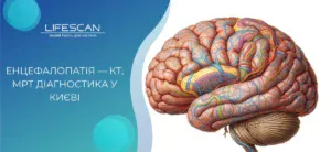 Енцефалопатія