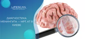 Диагностика менингита