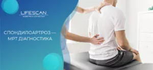 Спондилоартроз