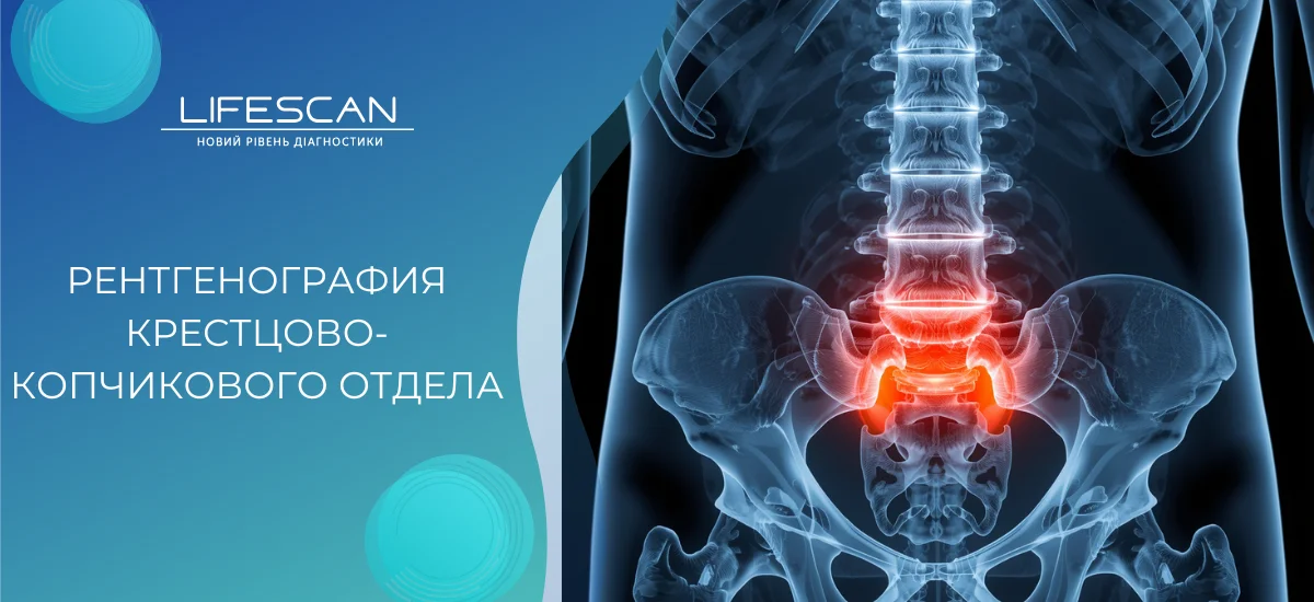 Рентгенография крестцово-копчикового отдела