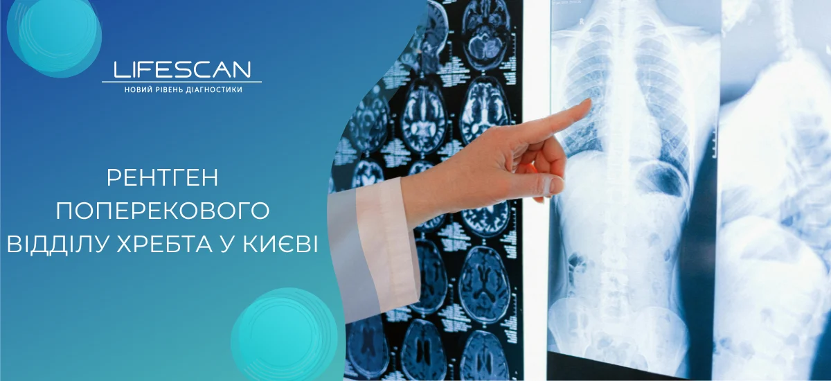 Рентгенографія поперекового відділу хребта