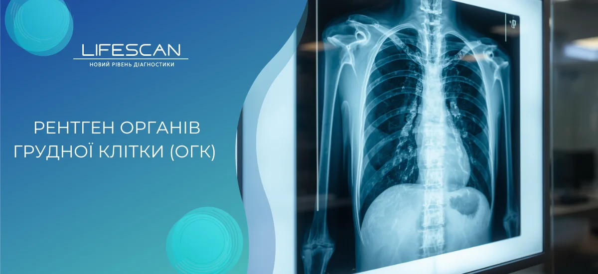 Рентген органів грудної клітки (ОГК) у Києві