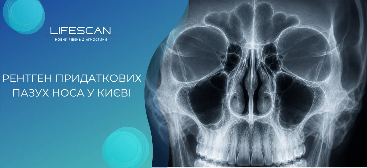 Рентген придаткових пазух носа у Києві