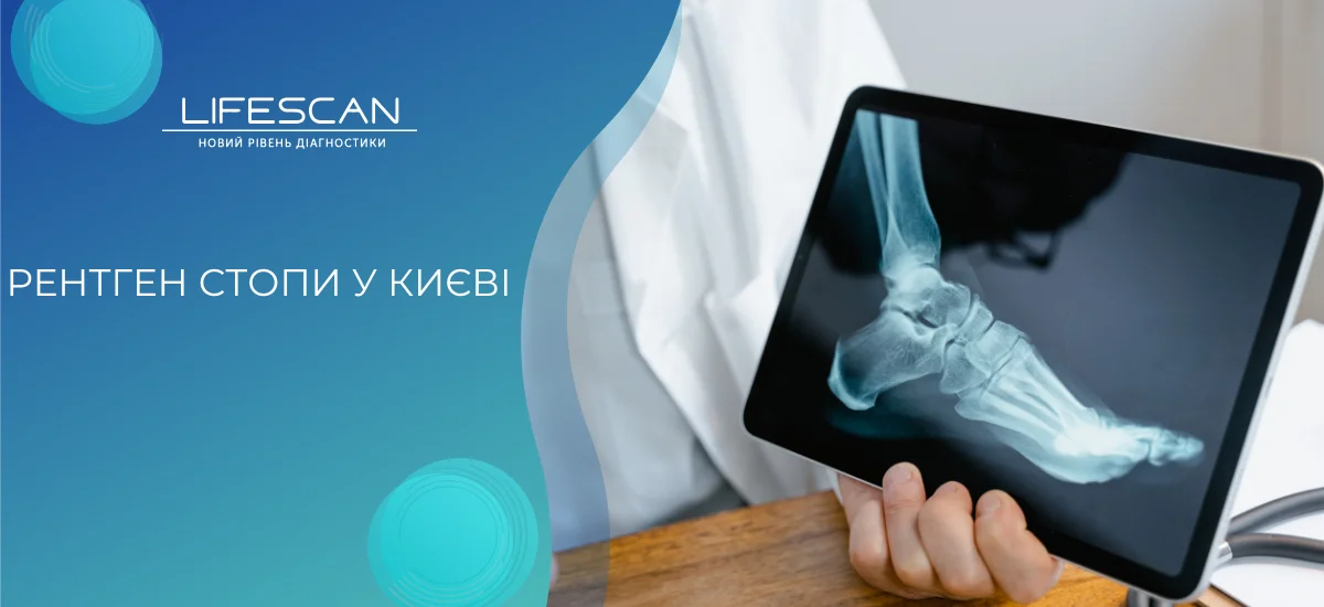 Рентген стопи у Києві