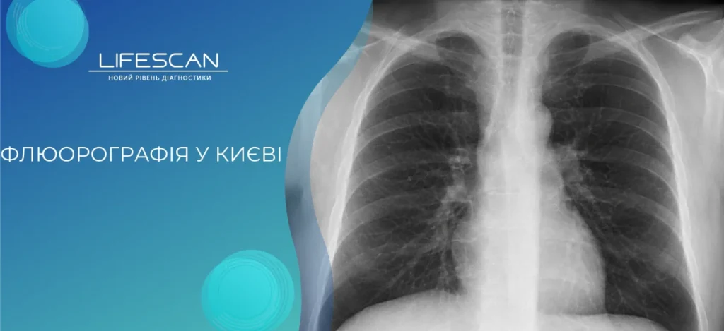 Флюорографія у Києві