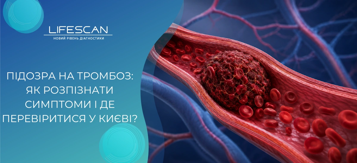 Підозра на тромбоз