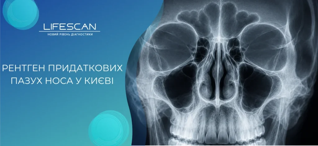 Рентген придаткових пазух носа у Києві