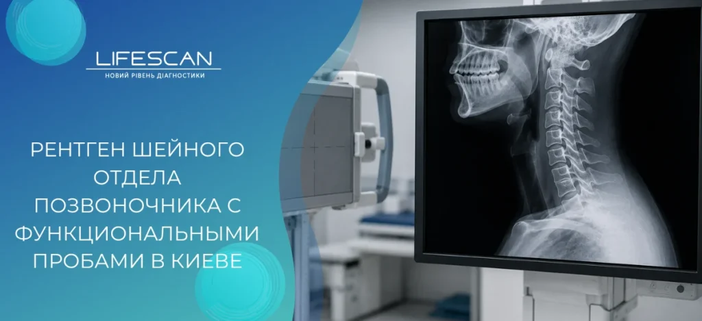 Рентген шейного отдела позвоночника с функциональными пробами