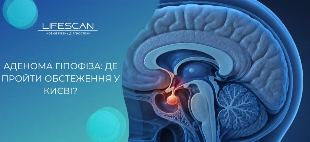 Аденома гіпофіза