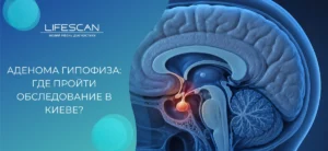 Аденома гипофиза: где пройти обследование в Киеве