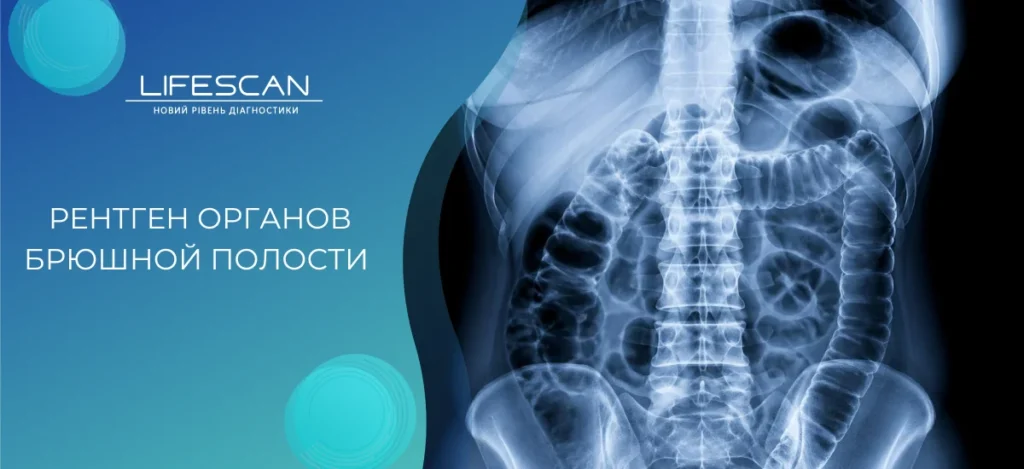 Рентген органов брюшной полости