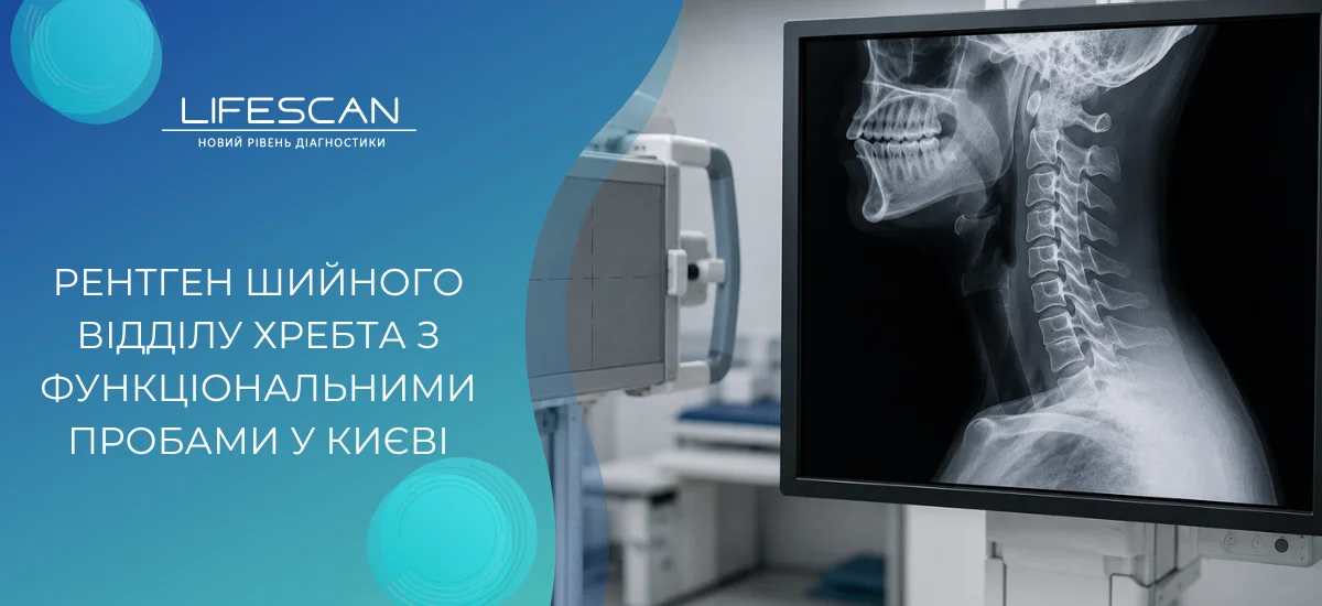 Рентген шийного відділу хребта з функціональними пробами