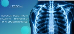 Перелом ребер після падіння