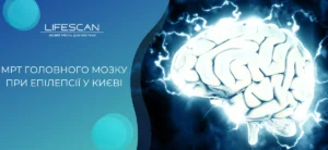 МРТ головного мозку при епілепсії