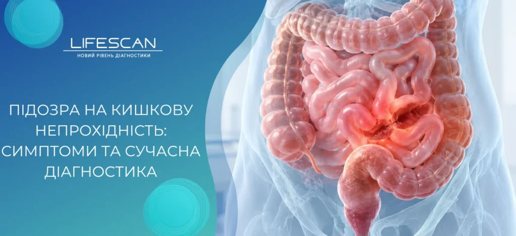 Підозра на кишкову непрохідність