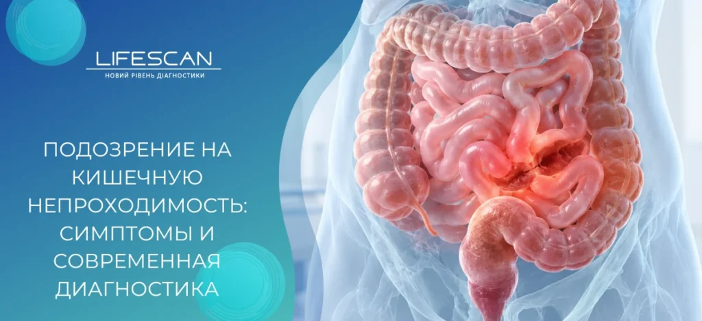 Подозрение на кишечную непроходимость