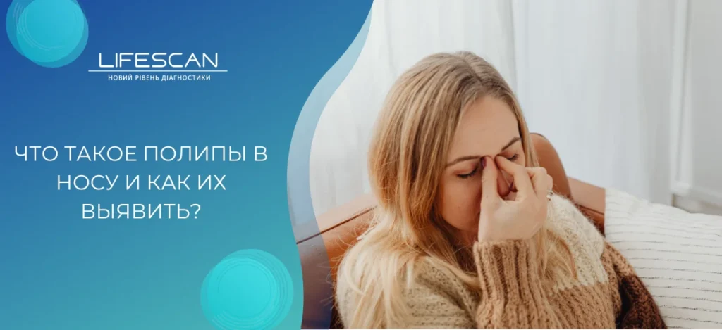 Что такое полипы в носу и как их выявить